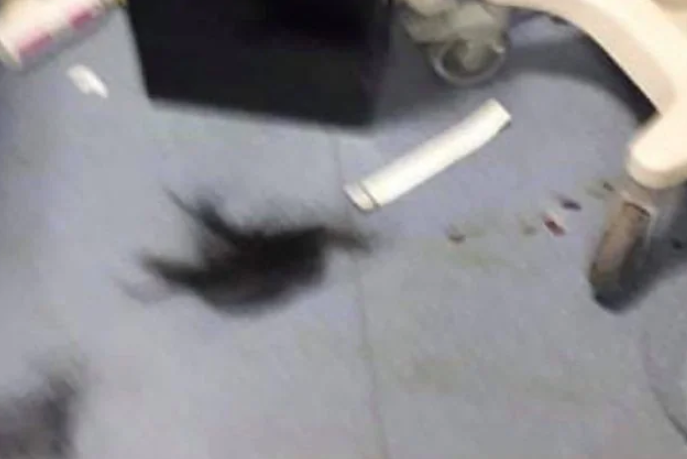 恐怖!意夫妇急诊室久等引不满,竟打断护士2根肋骨,还要挖眼睛! ...