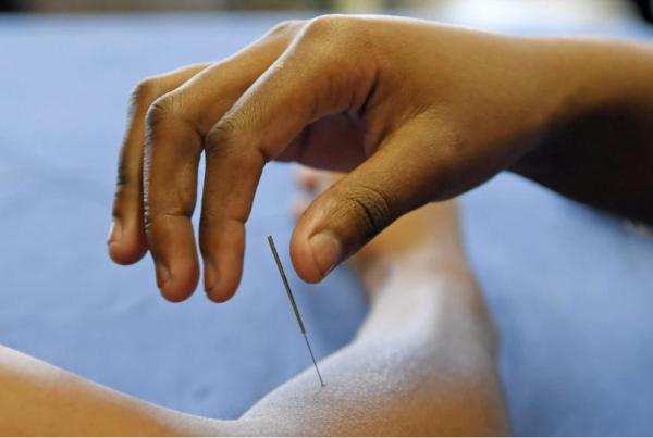 在南非约翰内斯堡大学针灸课上，一名学生在同学手臂上练习针法。新华社记者 陈诚 摄