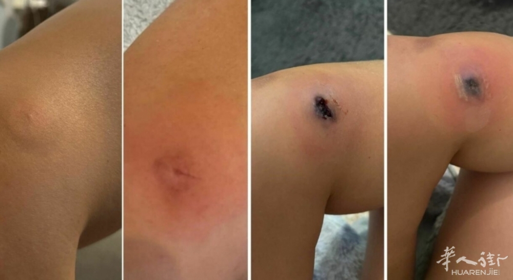 8308118_21082205_ra.jpg 8308118_21082205_ra.jpg